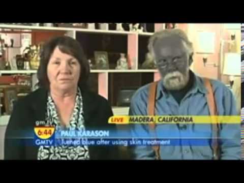 guy turns blue from colloidal silver
